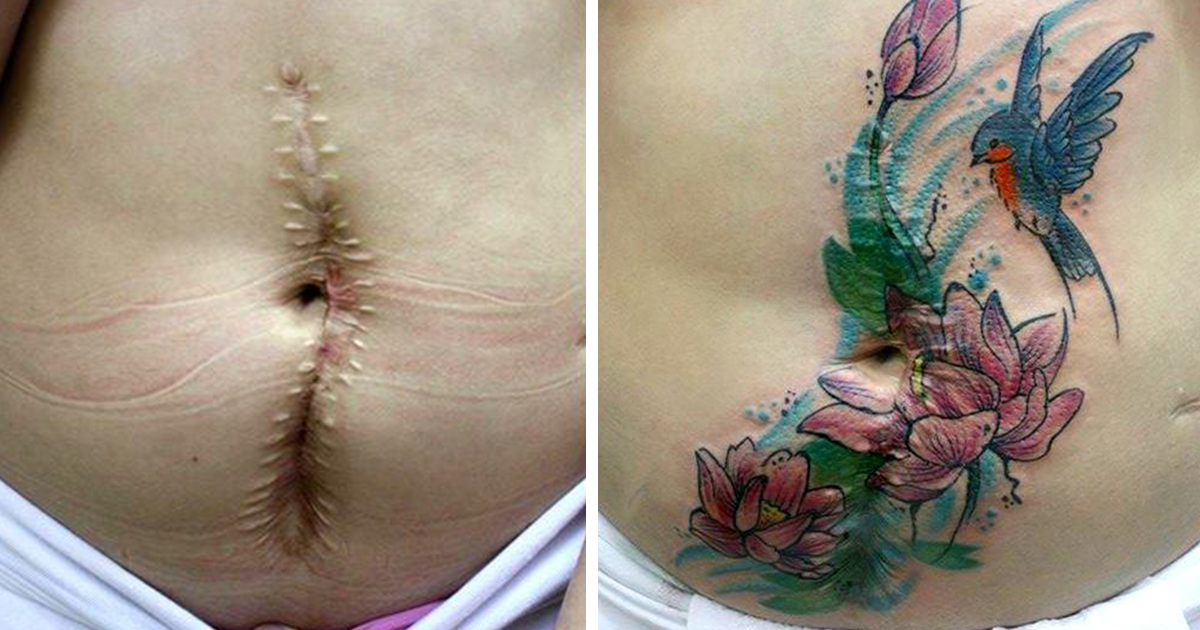 Essa Mulher Faz Tatuagens Gratuitas Para Sobreviventes De Violência Doméstica